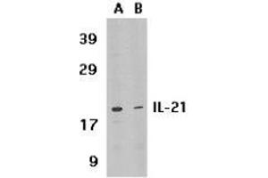 Western blot analysis of IL-21 expression in HL-60 cell lysate in the absence (lane A) or presence of blocking peptide (lane B) with AP30413PU-N IL-21 antibody at 1 μg /ml. (IL-21 anticorps  (Intermediate Domain))