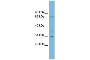 WB Suggested Anti-TBCCD1 Antibody Titration: 0. (TBCCD1 anticorps  (N-Term))