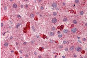 Human Liver: Formalin-Fixed, Paraffin-Embedded (FFPE)