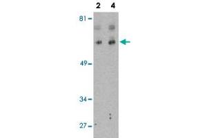 Western blot analysis of BCL2L13 in K-562 cell lysate with BCL2L13 polyclonal antibody  at 2 and 4 ug/mL .