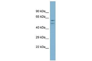 ATP6V1B1 antibody used at 1 ug/ml to detect target protein. (ATP6V1B1 anticorps  (Middle Region))