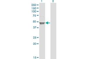 Western Blot analysis of ACAA1 expression in transfected 293T cell line by ACAA1 monoclonal antibody (M01), clone 3F11.