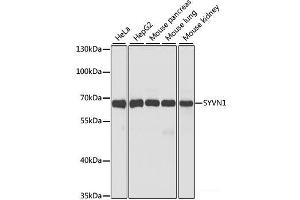 Western blot analysis of extracts of various cell lines using SYVN1 Polyclonal Antibody at dilution of 1:1000. (SYVN1 anticorps)