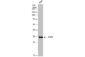 WB Image CD74 antibody detects CD74 protein by western blot analysis.