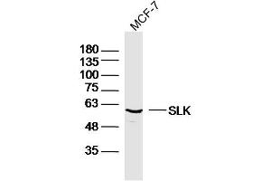 anti-STE20-Like Kinase (SLK) (AA 165-270) antibody