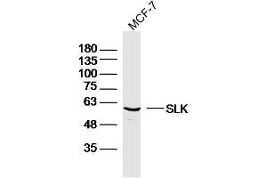 MCF-7 lysates probed with SLK Polyclonal Antibody, Unconjugated  at 1:300 dilution and 4˚C overnight incubation. (SLK anticorps  (AA 165-270))