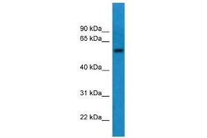 Western Blot showing CNDP1 antibody used at a concentration of 1-2 ug/ml to detect its target protein.