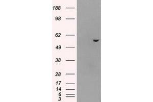 HEK293T cells were transfected with the pCMV6-ENTRY control (Left lane) or pCMV6-ENTRY ATP5B (Right lane) cDNA for 48 hrs and lysed.