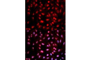 Immunofluorescence analysis of MCF-7 cells using Phospho-Dnmt1-pY399 antibody (ABIN5969883).
