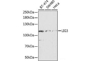 Western blot analysis of extracts of various cell lines using LIG3 Polyclonal Antibody at dilution of 1:1000. (LIG3 anticorps)