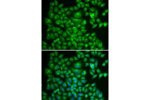 Immunofluorescence analysis of A549 cell using DTNBP1 antibody.