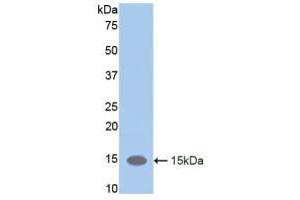 Western blot analysis of recombinant Mouse LIFR. (LIFR anticorps  (AA 381-485))