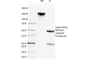 SDS-PAGE Analysis Purified CD28 Mouse Monoclonal Antibody (C28/1636). (CD28 anticorps)