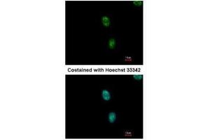 ICC/IF Image Immunofluorescence analysis of methanol-fixed HeLa, using SAP130, antibody at 1:500 dilution. (SF3B3 anticorps  (C-Term))