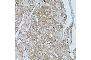 Immunohistochemistry of paraffin-embedded rat heart using FLII antibody (ABIN7267217) at dilution of 1:100 (40x lens). (FLII anticorps  (AA 400-660))