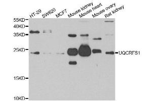 Western blot analysis of extracts of various cell lines, using UQCRFS1 antibody. (UQCRFS1 anticorps)