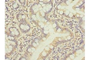 Immunohistochemistry of paraffin-embedded human small intestine tissue using ABIN7145307 at dilution of 1:100