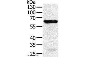 Western blot analysis of Jurkat cell, using TRAF5 Polyclonal Antibody at dilution of 1:450 (TRAF5 anticorps)