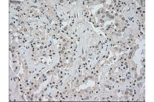 Image no. 2 for anti-Neurotrophic tyrosine Kinase, Receptor, Type 3 (NTRK3) antibody (ABIN1499842)