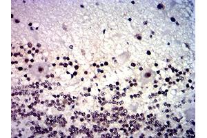 Immunohistochemical analysis of paraffin-embedded cerebellum tissues using MYCN mouse mAb with DAB staining.