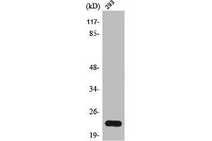 Western Blot analysis of 293 cells using Trypsin-1 Polyclonal Antibody (PRSS1 anticorps  (Internal Region))