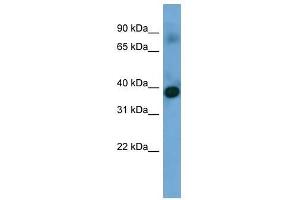 Western Blot showing SFXN4 antibody used at a concentration of 1-2 ug/ml to detect its target protein. (Sideroflexin 4 anticorps  (N-Term))