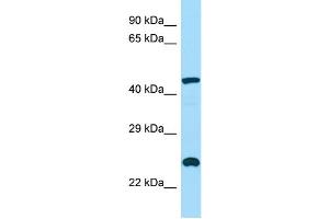 WB Suggested Anti-INPP5A Antibody Titration: 1. (INPP5A anticorps  (C-Term))