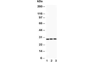 Western blot testing of ATF1 antibody and Lane 1:  rat spleen;  2: HeLa;  3: COLO320 (AFT1 anticorps  (AA 1-271))