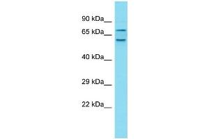 Host: Rabbit Target Name: CXorf30 Sample Type: Fetal Liver lysates Antibody Dilution: 1.