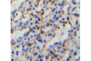 IHC-P analysis of Spleen tissue, with DAB staining. (CD21 anticorps  (AA 729-957))