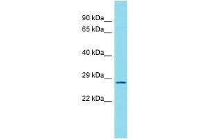 Host: Rabbit Target Name: C17orf77 Sample Type: RPMI-8226 Whole Cell lysates Antibody Dilution: 1. (C17ORF77 anticorps  (C-Term))
