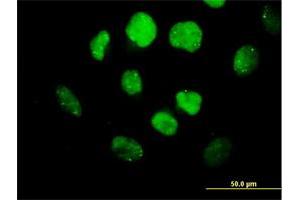 Immunofluorescence of purified MaxPab antibody to OLIG3 on HeLa cell.