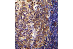 His6-DEP-1 Antibody (ABIN655037 and ABIN2844669) immunohistochemistry analysis in formalin fixed and paraffin embedded human tonsil tissue followed by peroxidase conjugation of the secondary antibody and DAB staining. (PTPRJ anticorps  (His6))