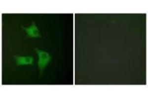 Immunofluorescence analysis of HeLa cells, using p15 INK antibody. (CDKN2B anticorps)