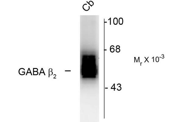 GABRB2 抗体  (Cytoplasmic Loop)