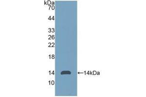 Detection of Recombinant Thy1, Human using Polyclonal Antibody to Cluster of Differentiation 90 (CD90) (CD90 anticorps  (AA 20-133))