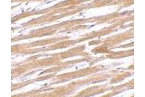 Immunohistochemistry of GPVI in human heart tissue with GPVI antibody at 10 μg/ml.