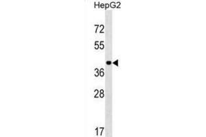 Western Blotting (WB) image for anti-Leucine Rich Repeat Protein 1 (LRR1) antibody (ABIN2999950)