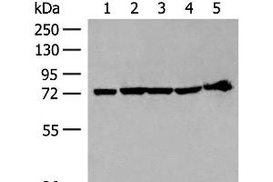 Western blot analysis of 293T cell and Mouse heart tissue lysates using CALCOCO1 Polyclonal Antibody at dilution of 1:300 (CALCOCO1 anticorps)