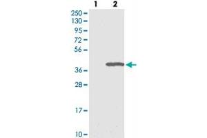 Western blot analysis of Lane 1: Negative control (vector only transfected HEK293T lysate), Lane 2: Over-expression Lysate (Co-expressed with a C-terminal myc-DDK tag (~3. (ERGIC1 anticorps)