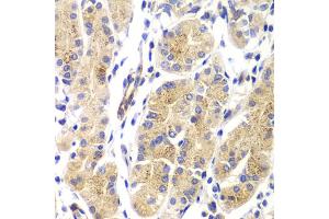 Immunohistochemistry of paraffin-embedded human gastric using HRAS antibody (ABIN5975854) at dilution of 1/100 (40x lens). (HRAS anticorps)