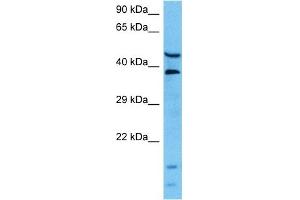Host:  Mouse  Target Name:  L Sample Tissue:  Mouse Pancreas  Antibody Dilution:  1ug/ml (LARP6 anticorps  (Middle Region))