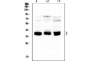 Western blot analysis of CXCR4 using anti-CXCR4 antibody (ABIN6719552).