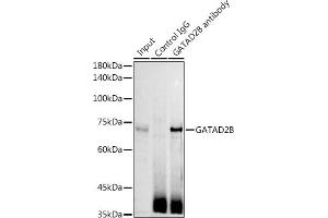 Immunoprecipitation analysis of 300 μg extracts of Jurkat cells using 3 μg GB antibody (ABIN6127943, ABIN6140978, ABIN6140979 and ABIN6225075). (GATAD2B anticorps  (AA 1-120))