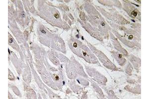 Immunohistochemistry analyzes of Pax-1 antibody in paraffin-embedded human heart tissue. (PAX1 anticorps)