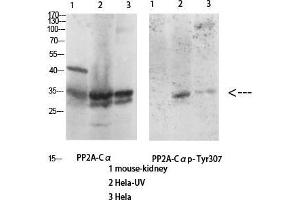 Western Blot (WB) analysis of specific cells using Antibody diluted at 1:1000. (PPP2CA anticorps  (Thr278))