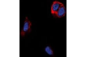 Immunofluorescent analysis of TRB1 staining in MCF7 cells. (TAS2R14 anticorps)