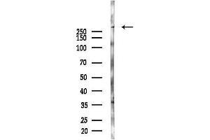 Western blot analysis of lysates from Rat brain, using Collagen VII alpha 1 Antibody at 1/1000 dilution.