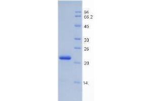 SDS-PAGE analysis of Rat Insulin Like Growth Factor Binding Protein 3 (IGFBP3) Protein. (IGFBP3 Protéine)