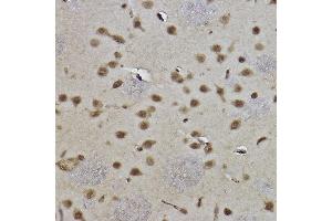 Immunohistochemistry of paraffin-embedded rat brain using MonoMethyl-Histone H3-K9 antibody (ABIN7267685) at dilution of 1:100 (40x lens). (Histone 3 anticorps  (H3K9me))